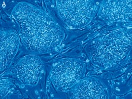 Stem cells. Wikimedia Commons