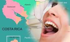 Costa Rica Dental Work