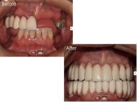 Source: New Smile Dental Group